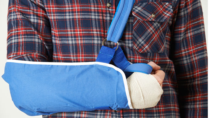 A person with an injured right arm. It is bandaged and in a blue sling