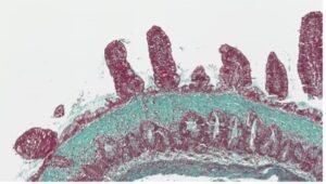 Intestinal biopsy specimen from cats, stained with Masson’s trichrome stain and anti-vimentin and anti-collagen I antibodies