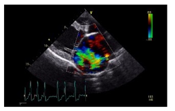 An animal heart scan