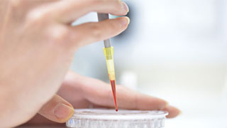 Placing a blood sample onto a petri dish