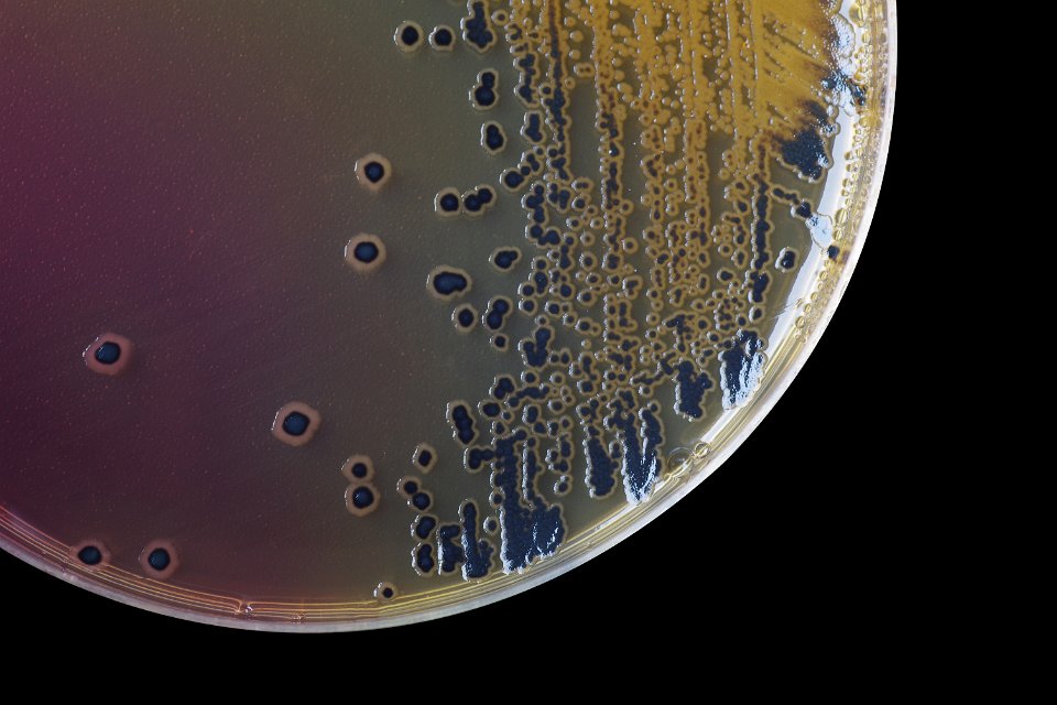 Closeup of a petri dish, with a sample inside