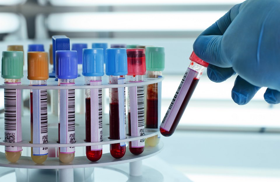 Test tubes in a lab with animal blood samples